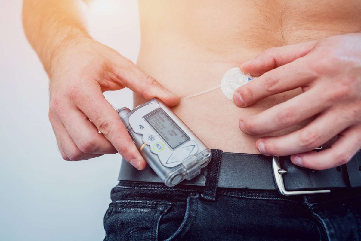 Diabetik_s_insulinovoy_pompoy_podklyuchennoy_k_.original